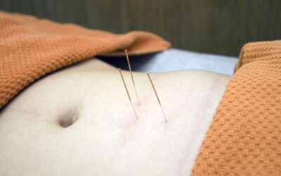 Acupuntura y masaje abdominal en la Medicina Tradicional China: terapias complementarias para el equilibrio interno